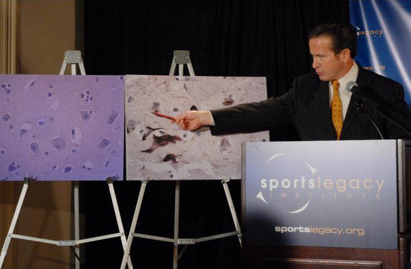 Doctor Pro wrestler Benoits concussions may have contributed to