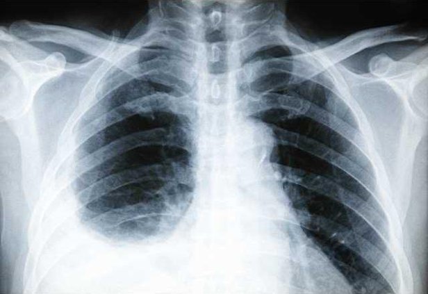 aafd226cd0b78e0aa11151a5aaf61a028e77e57f16e5c0abc26b2fa80096cb38