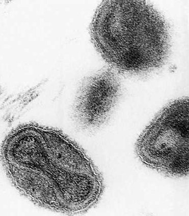 W Forgotten Smallpox Heal